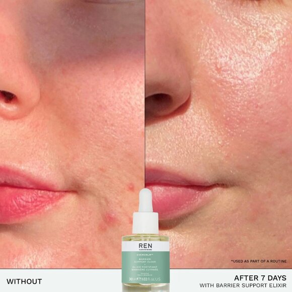 REN Clean Skincare Evercalm™ Barrier Support Elixir | NEW PRODUCT - Picture 2 of 3